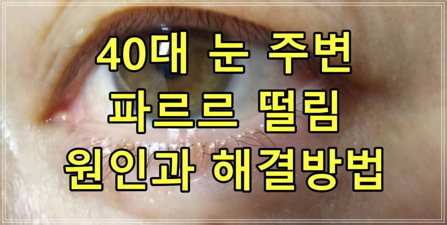 40대 눈 주변 파르르 떨림 원인과 해결방법