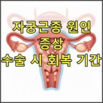 자궁근종 원인, 증상, 수술 시 회복 기간