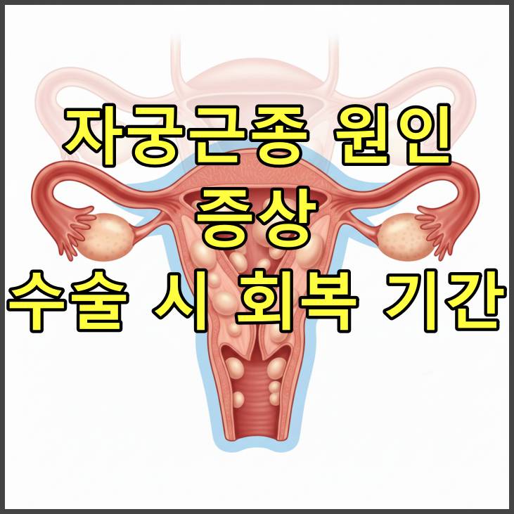 자궁근종 원인, 증상, 수술 시 회복 기간