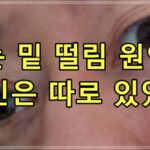 눈 밑 떨림 원인, 범인은 따로 있었네
