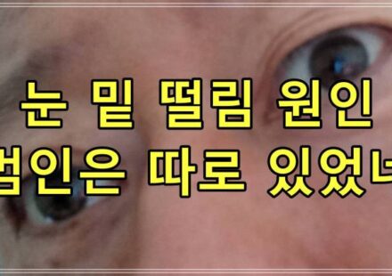 눈 밑 떨림 원인, 범인은 따로 있었네