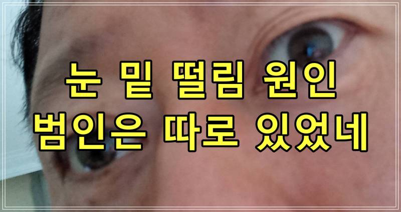 눈 밑 떨림 원인, 범인은 따로 있었네