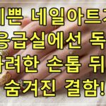 예쁜 네일아트가 응급실에선 독? 화려한 손톱 뒤에 숨겨진 결함!