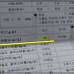 건강 검진에서 받은 공복 혈당 128 (몸에 이런 변화가 보인다면 당뇨는 시작 된 거다. 나만의 혈당 관리 법)