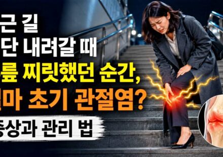 계단에서 내려오는 여성이 무릎 통증으로 멈춰서 있다.