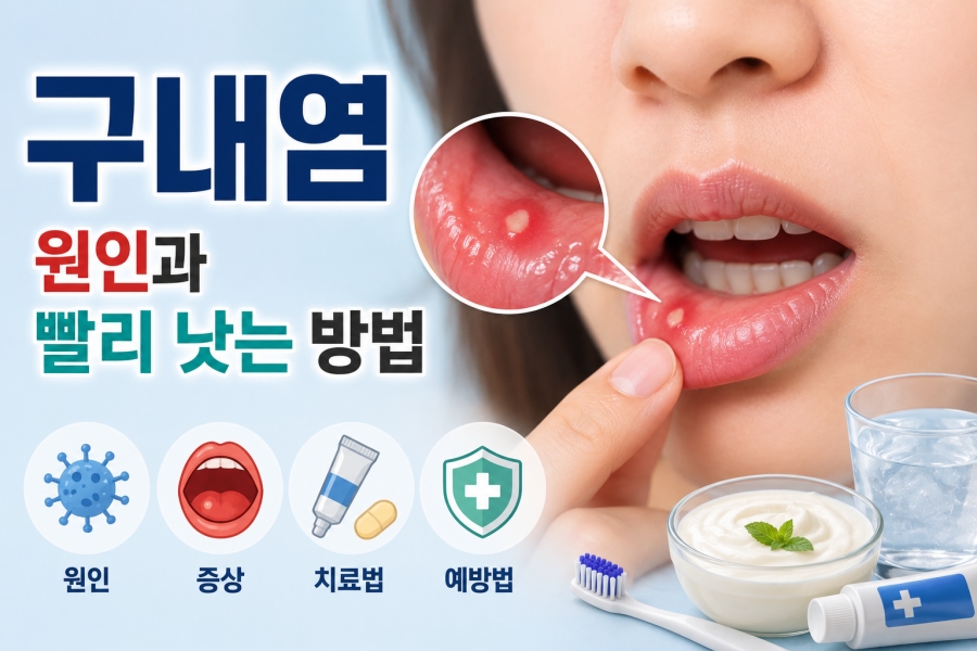 구내염 걸리는 원인과 빨리 낫는 방법