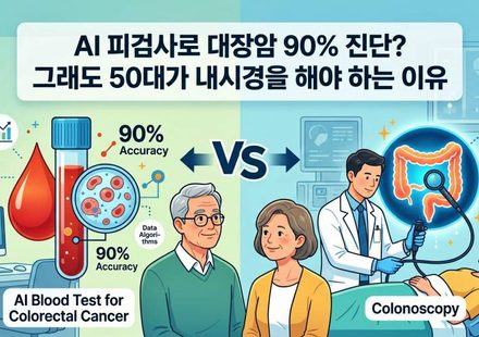 AI 피검사로 대방암 90% 진단?